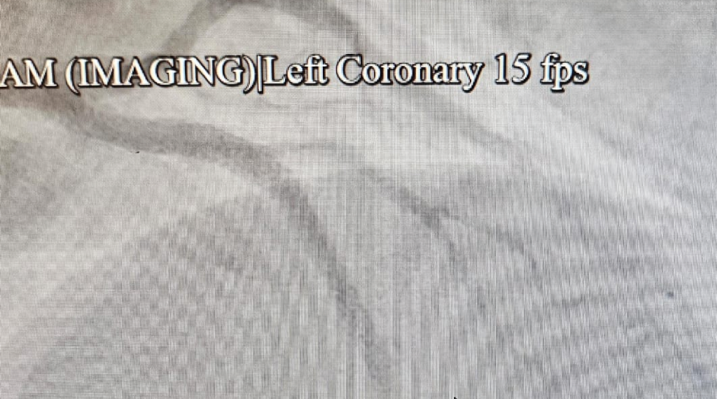 1 01